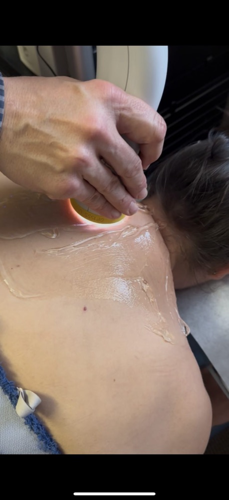 A SoftWave therapy applicator delivering broad-focused shockwaves to a patient's neck and upper back at Hansen Chiropractic in West Babylon
